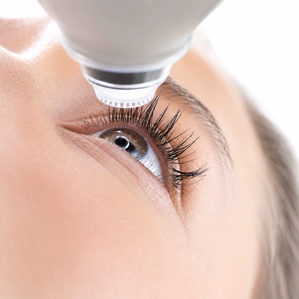 Cirugia Refractiva Laser 2